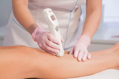 Depilacja Laserowa Vectus - Sudoł